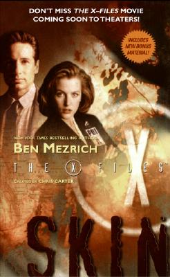 X-Files: Skin (The X-Files)