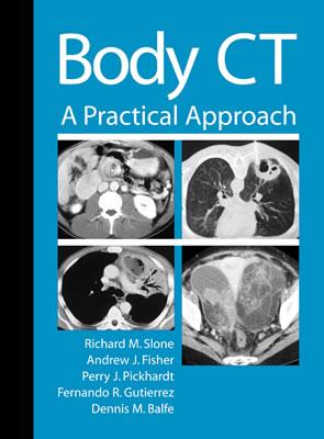 Image for Body CT: A Practical Approach