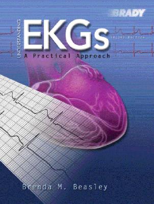 Understanding EkGs: A Practical Approach