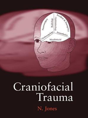 Craniofacial of Trauma