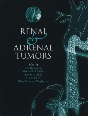 Renal and Adrenal Tumors: Biology and Management