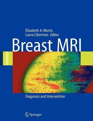 Image for Breast MRI: Diagnosis and Intervention