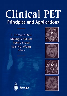 Clinical PET: Principles and Applications
