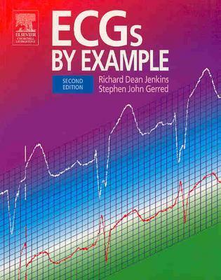 ECGs by Example