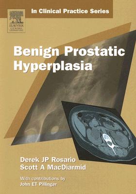 Churchill's In Clinical Practice Series: Benign Prostatic Hyperplasia