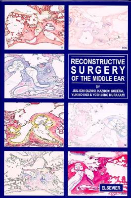 Reconstructive Surgery of the Middle Ear