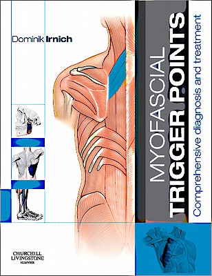 Myofascial Trigger Points: Comprehensive diagnosis and treatment