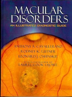 Image for Macular Disorders: An Illustrated Diagnostic Guide Macular Disorders: An Illustrated Diagnostic Guide