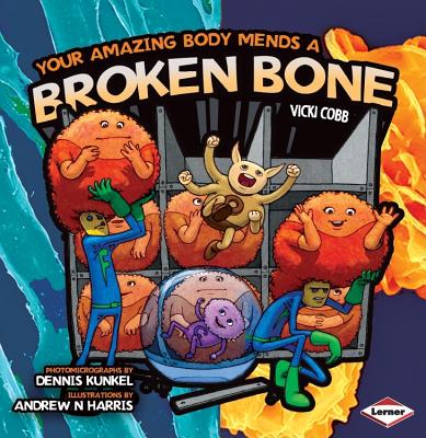 Your Amazing Body Mends a Broken Bone (Your Amazing Body)