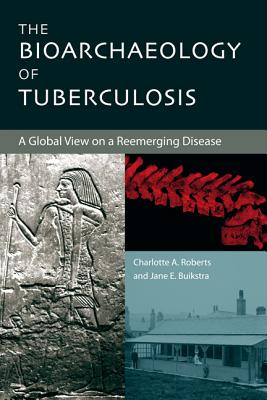 THE BIOARCHAEOLOGY OF TUBERCULOSIS: A GLOBAL VIEW ON A REEMERGING DISEASE