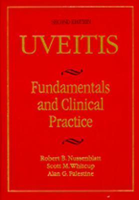 Uveitis: Fundamentals and Clinical Practice