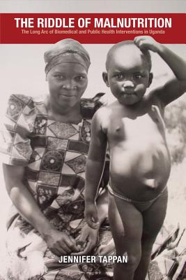 The Riddle of Malnutrition: The Long Arc of Biomedical and Public Health Interventions in Uganda (Perspectives on Global Health)