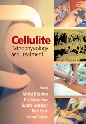 Cellulite: Pathophysiology and Treatment (Basic and Clinical Dermatology)