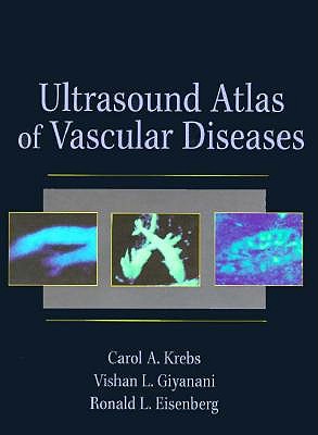Ultrasound Atlas of Vascular Diseases