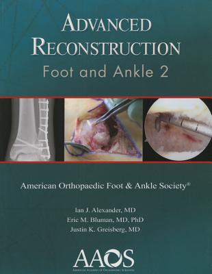 Advance Reconstruction Foot and Ankle 2
