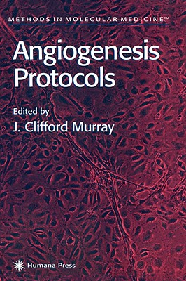 Angiogenesis Protocols (Methods in Molecular Medicine)