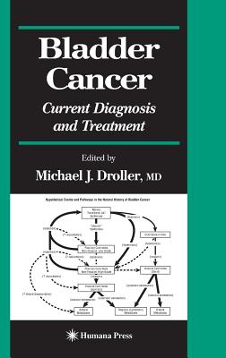 Bladder Cancer: Current Diagnosis and Treatment (Current Clinical Urology)
