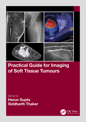 Image for Practical Guide for Imaging of Soft Tissue Tumours Practical Guide for Imaging of Soft Tissue Tumours