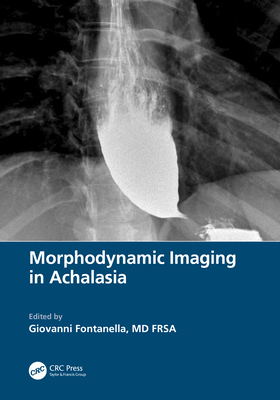 Image for Morphodynamic Imaging in Achalasia Morphodynamic Imaging in Achalasia