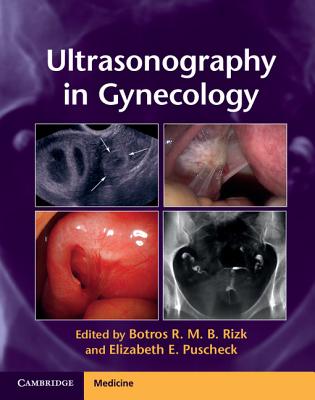 Image for Ultrasonography in Gynecology Ultrasonography in Gynecology