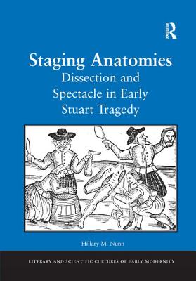 Staging Anatomies (Literary and Scientific Cultures of Early Modernity)