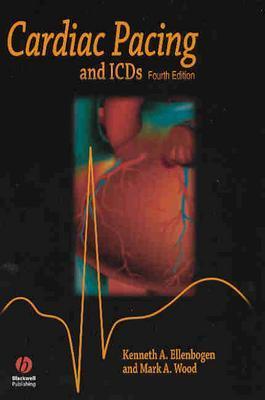 Cardiac Pacing And Icds