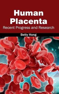 Human Placenta: Recent Progress and Research Image for Human Placenta: Recent Progress and Research