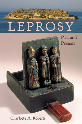 LEPROSY: PAST AND PRESENT