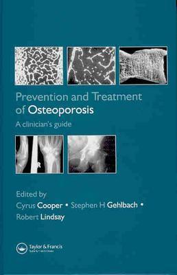 Prevention and Treatment of Osteoporosis in the High-Risk Patient: A Clinician's Guide
