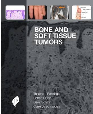 Bone and Soft Tissue Tumors: A Multidisciplinary Review with Case Presentations