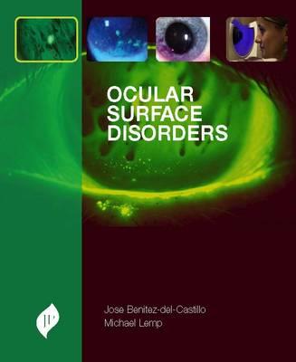 Ocular Surface Disorders