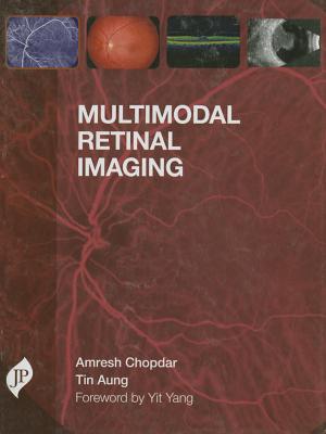 Multimodal Retinal Imaging