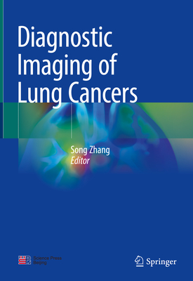 Diagnostic Imaging of Lung Cancers